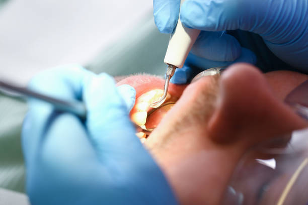 Best Emergency Dental Services for Seniors in Chamberlayne, VA