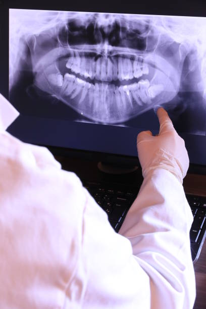 Best Emergency Dental Extractions in Chamberlayne, VA