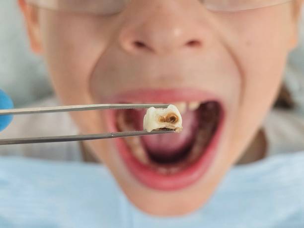 Best Emergency Dental Services for Seniors in Chamberlayne, VA