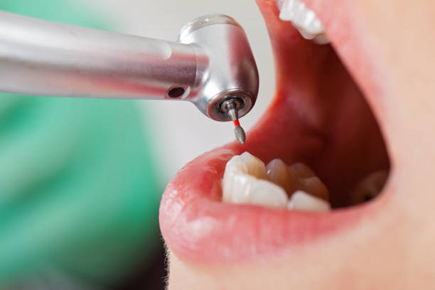Best Weekend Emergency Dentist in Chamberlayne, VA